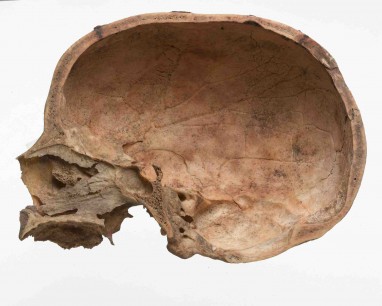 Bisected skull © Museum of London Archaeology