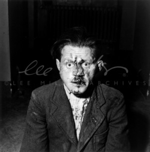 Lee Miller ©Lee Miller Archives, Beaten SS prison guard, Buchenwald, Germany