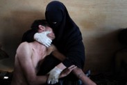 Samuel Aranda, A woman holds a wounded relative in her arms, inside a mosque used as a field hospital by demonstrators against the rule of President Ali Abdullah Saleh, during clashes in Sanaa, Yemen on 15 October 2011. © Samuel Aranda